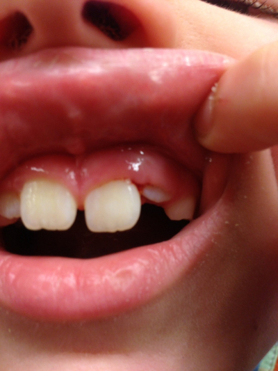 teeth-400x533.jpg